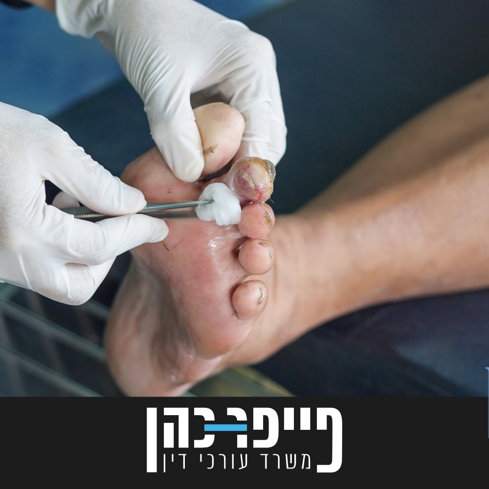סעיף 78 - אולקוס טרופיקיום