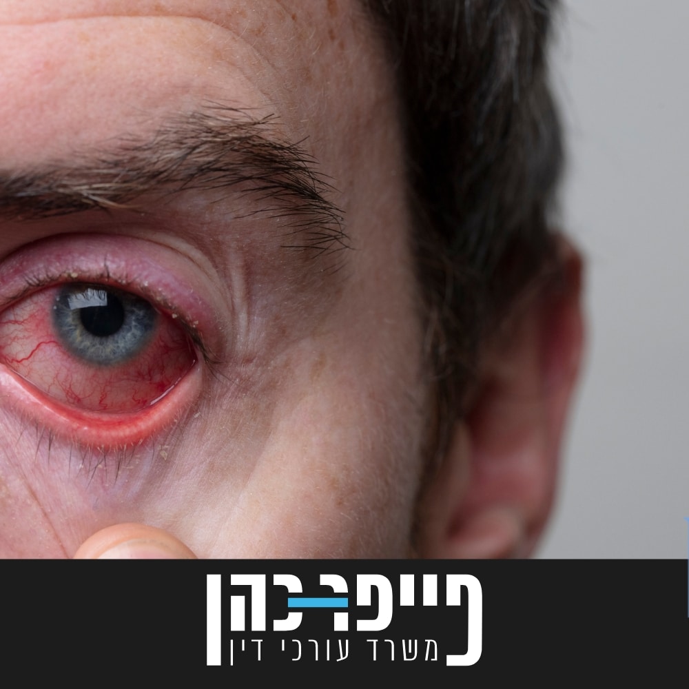 סעיף 66 - זגוגית