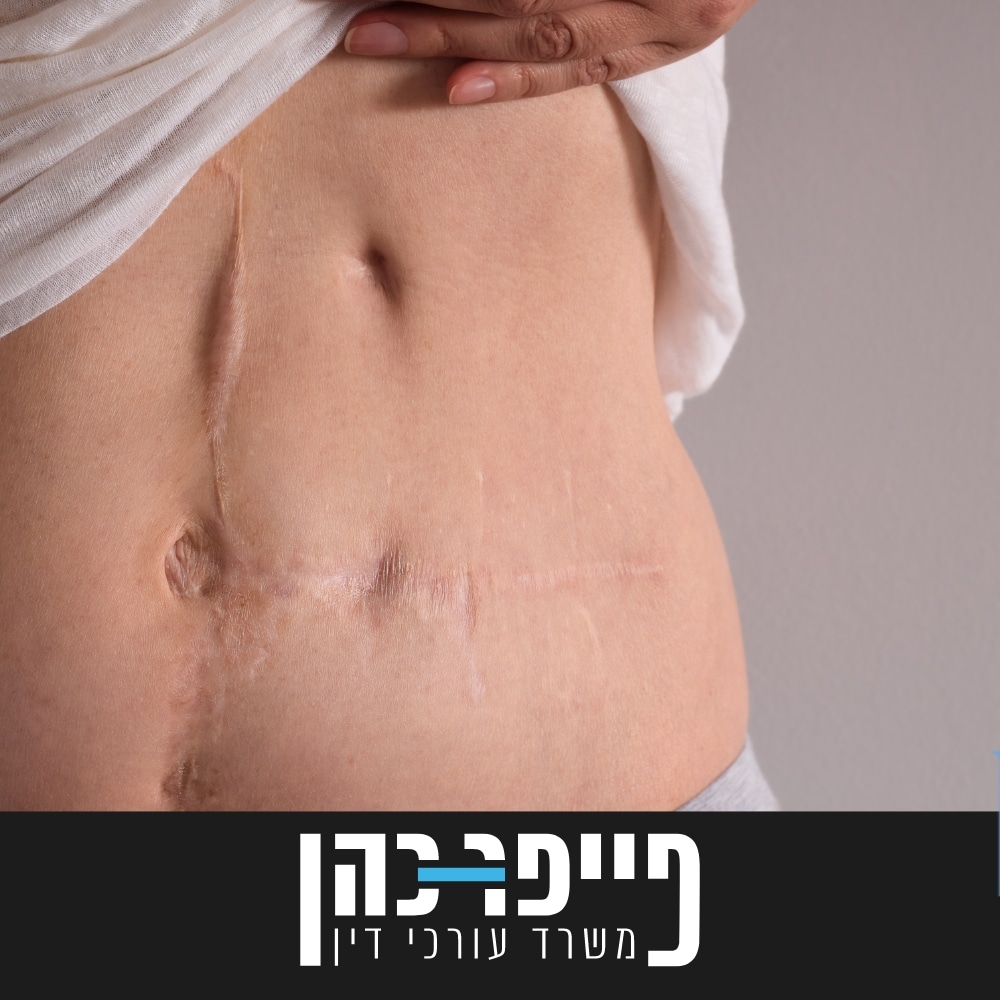 סעיף 75 - צלקות