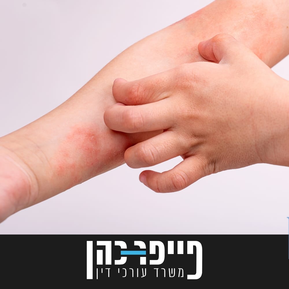 סעיף 83 - דרמטיטיס