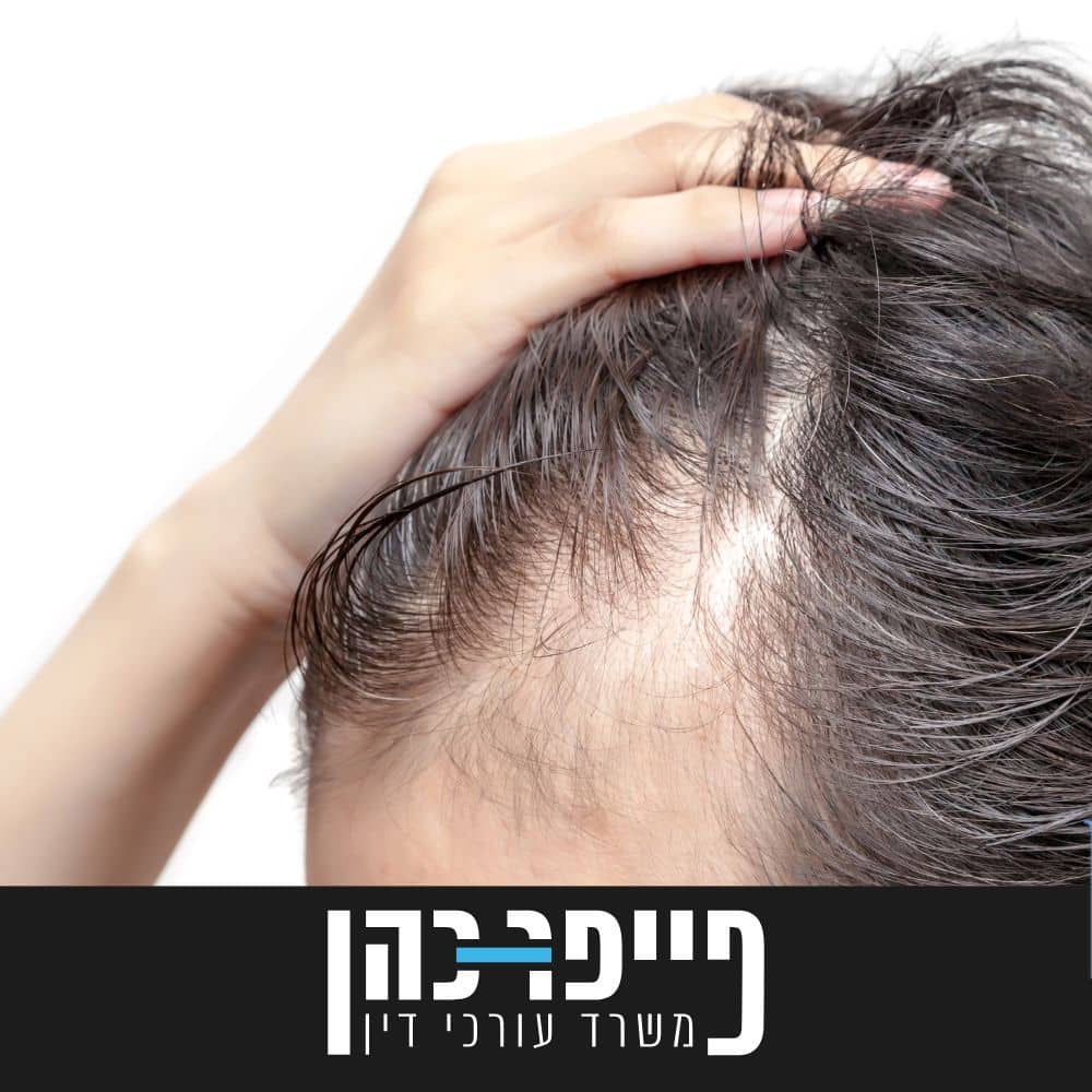 סעיף 76 - אלופציה אראטה